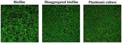 PCV13 vaccine prevents pneumococcal biofilms without affecting Staphylococcus aureus population within the polymicrobial biofilm